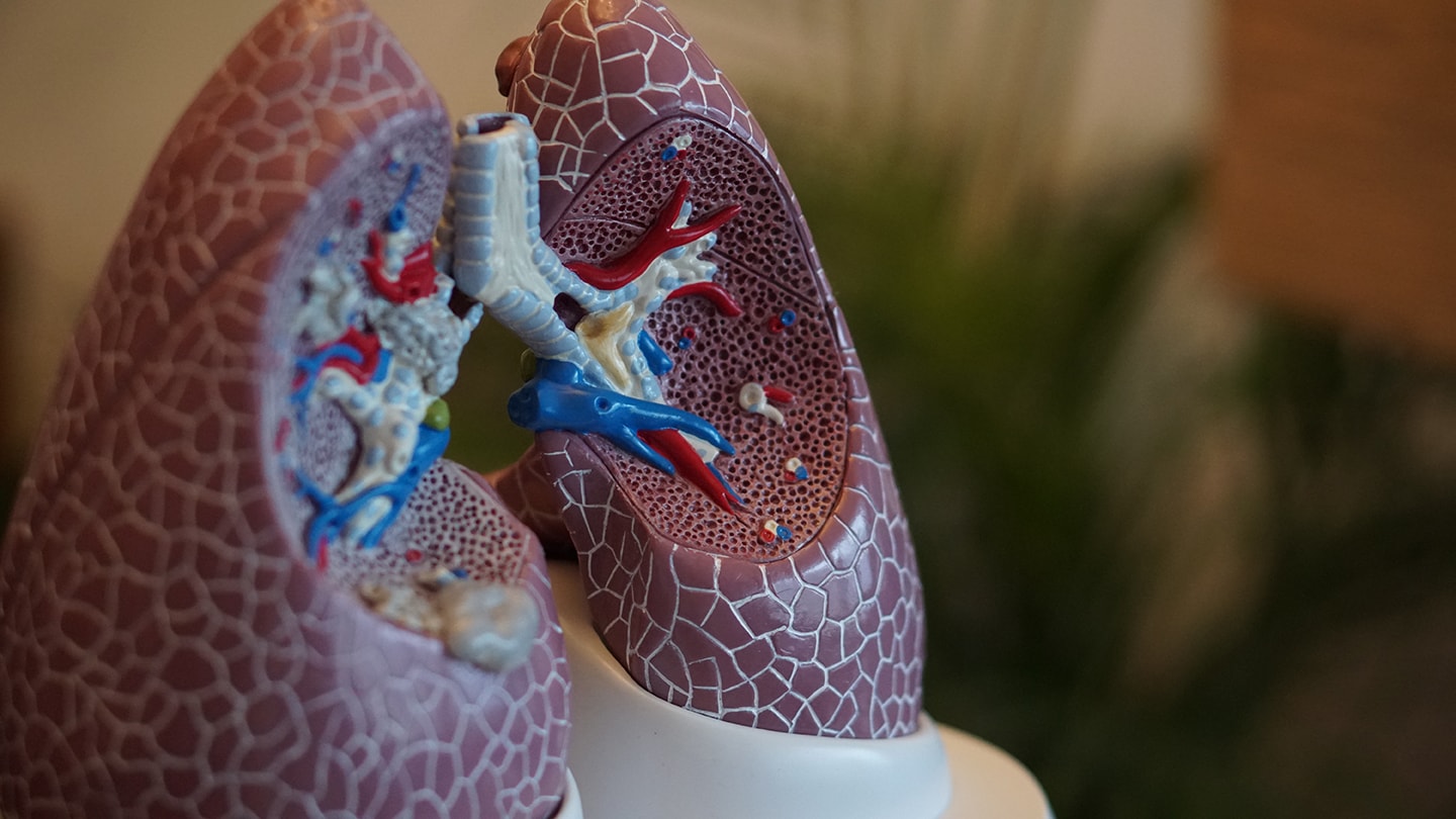 Image of Lungs